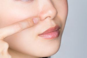 Rhinoplastie médicale